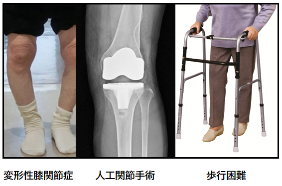 当院の施術法